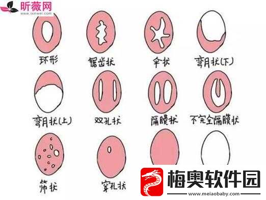 女生第一次过后出血是为什么原因：详细解析