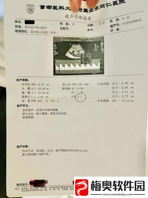 “OVO食肉族报告4”：创新狂潮下的热点解析