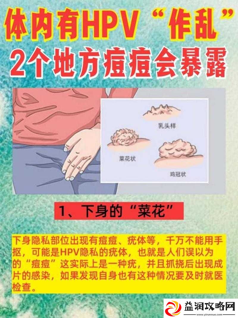 女生隐私部位起痘怎么治：专业医生解答