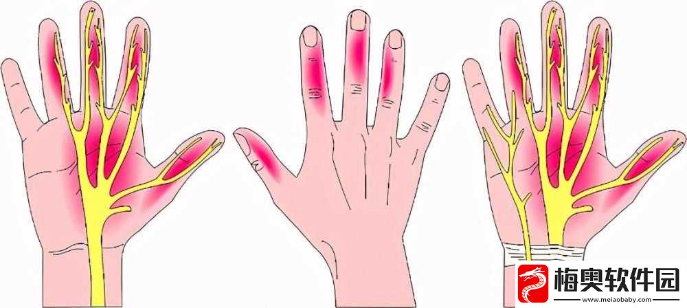 宝宝怎么才三根手指就痛：原因何在